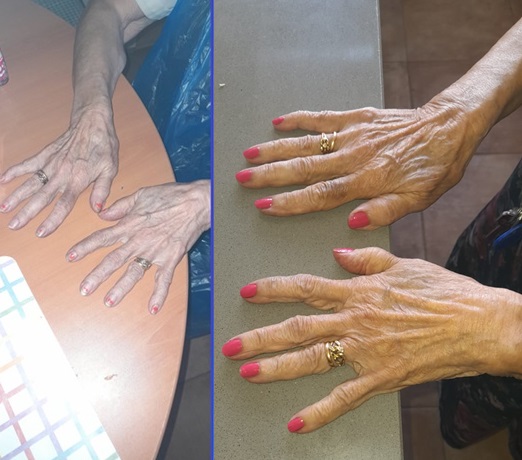 MAnicura a domicilio en Sevilla para mujeres ancianas